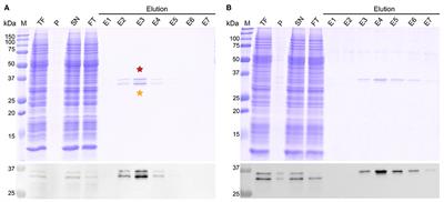 Phosphorylation and Alternative Translation on Wheat Germ Cell-Free Protein Synthesis of the DHBV Large Envelope Protein